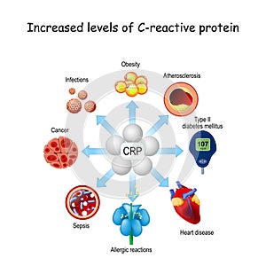C-reactive protein. crp photo