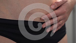 C-section scar on woman's belly. Childbirth in surgical way. Postpartum recovery