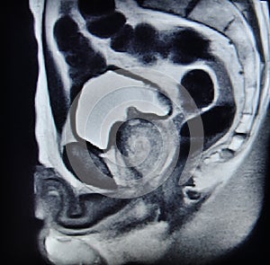 Ca prostate mri exam diagnostic