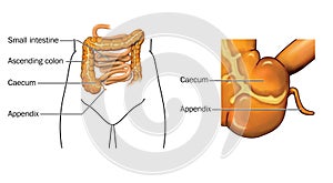 Caecum and appendix photo
