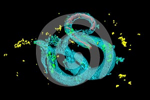 Caenorhabditis elegans