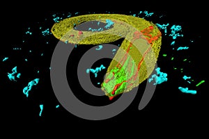 Caenorhabditis elegans