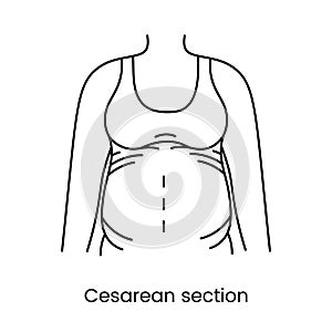Caesarean section views icon line in vector, illustration of a pregnant woman.