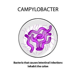 Campylobacter. Pathogenic flora. The bacterium causes intestinal diseases. Infographics. Vector illustration. photo