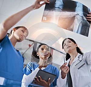 Can you see the difference. a group of doctors discussing the results of an X-ray in a hospital.