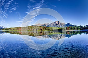 Canadian Landscape: Patricia Lake at Jasper National Park