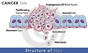 Cancer cell development entire mechanism including angiogenesis, metastasi, and proliferation with normal cells in the background photo