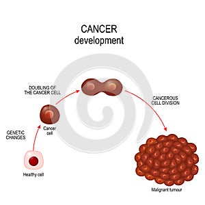 Cancer cell. illustration showing cancer disease development.