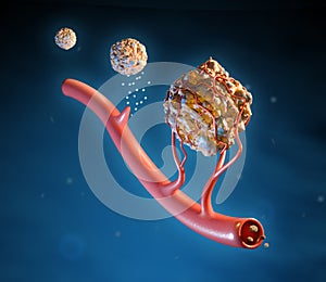 Angiogenesis in tumor growth