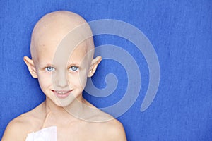 Cancer child portrait