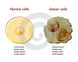 Cancer and normal cells. comparison and difference photo