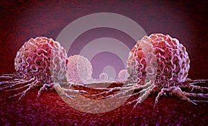 Cancer Oncology photo
