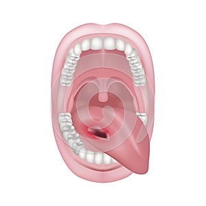 cancer of the tongue, oral cavity.