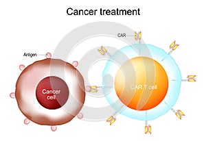 Cancer treatment and CAR T-cell therapy