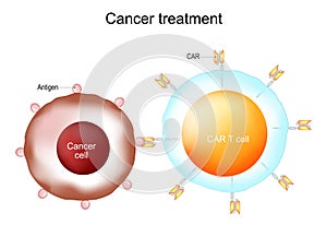 Cancer treatment and CAR T-cell therapy photo
