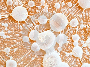 Cancer tumour macro photo.