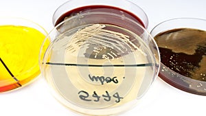 Candida albicans fungus on sabouraud agar