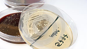 Candida albicans fungus on sabouraud agar