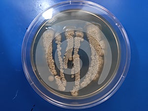 Candida albicans growing on sabouraud dextrose agar medium