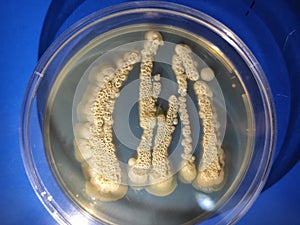 Candida albicans growing on sabouraud dextrose agar medium