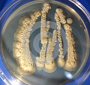 Candida albicans growing on sabouraud dextrose agar medium
