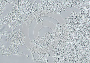 Candida biofilm