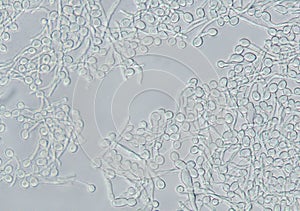 Candida biofilm photo