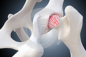 Canine Arthritis and Osteoarthritis joint inflammation