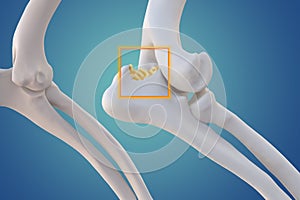 Canine Arthritis and Osteoarthritis joint inflammation