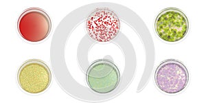 Capacities with preparations