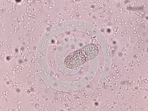 Capillaria philippinensis egg