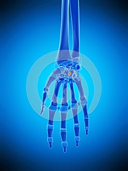 The capitohamate ligament photo