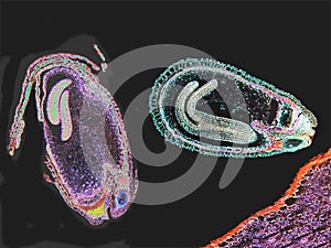 Capsella sp, mature embryos 40X