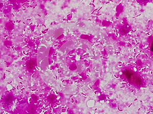 The Capsule of Clostridium perfringens photo