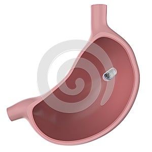 Capsule endoscopy in stomach