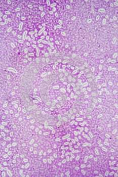 Capsule stain of bacillus bacteria