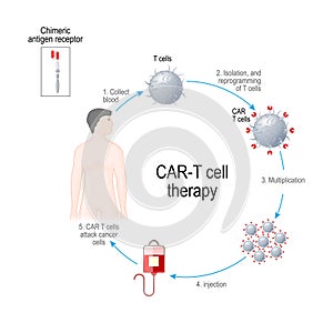 CAR T cell therapy. cancer immunotherapy. Artificial leukocyte receptors