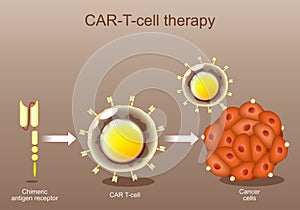 CAR-T cell therapy. cancer immunotherapy. Chimeric antigen receptor photo