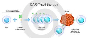 CAR T-cell therapy. cancer immunotherapy photo