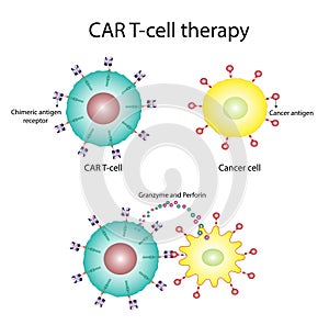CAR T-cell therapy and Cancer treatment. CAR T cells immunotherapy. Chimeric antigen receptor T cells. photo