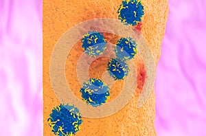 CAR T cell therapy in Rheumatoid arthritis - front view 3d illustration photo