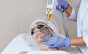 Carbon face peeling procedure in a beauty salon. Hardware cosmetology treatmen