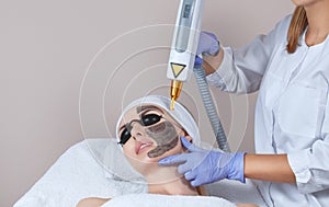 Carbon face peeling procedure in a beauty salon. Hardware cosmetology treatment