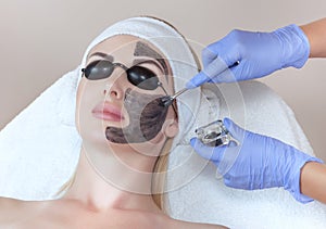 Carbon face peeling procedure in a beauty salon. Hardware cosmetology photo