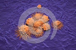 Carcinoma cells field in kidney cancer - isometric view 3d illustration