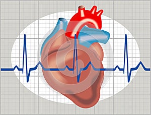 Cardiac arrhythmia photo