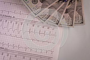 Cardiac arrhythmias recorded on paper. Ventricular Tachycardia American dollars on the medical desk