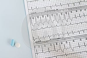 Cardiac arrhythmias recorded on paper. Ventricular Tachycardia Medicines on electrocardiograms. Medical desk