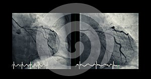 Cardiac catheterization can help doctor diagnose and treat problems in your heart and blood vessels that might otherwise cause