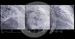 Cardiac catheterization can help doctor diagnose and treat problems in your heart and blood vessels that might otherwise cause